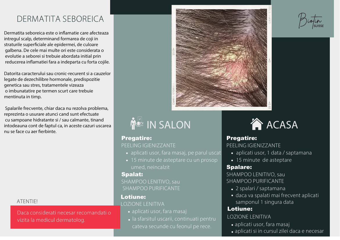 Dermatită seboreică